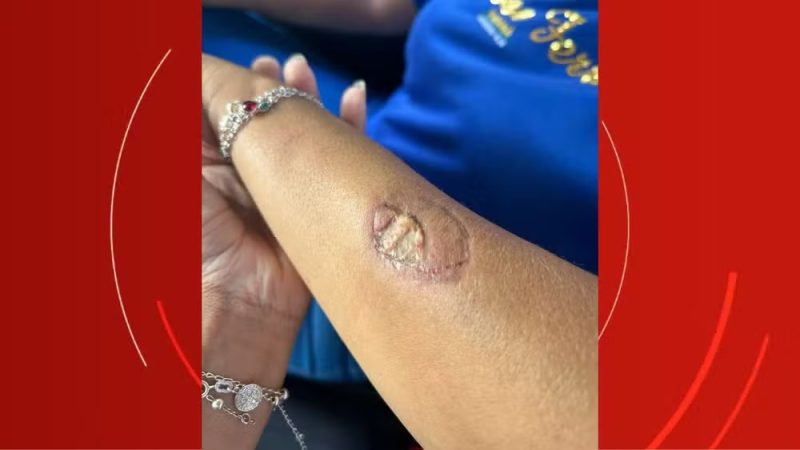 Segurança – Mãe de aluno agride funcionárias e morde vice-diretora dentro de escola no Paraná