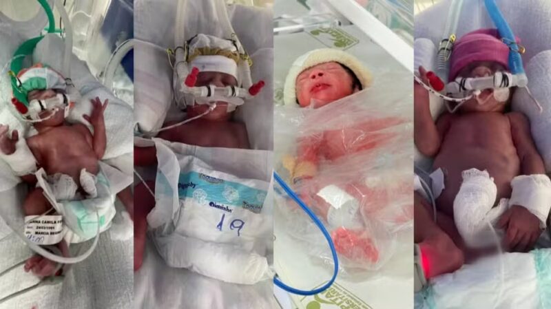 Londrina – Quadrigêmeos nascem após casal tentar ter filhos por quatro anos