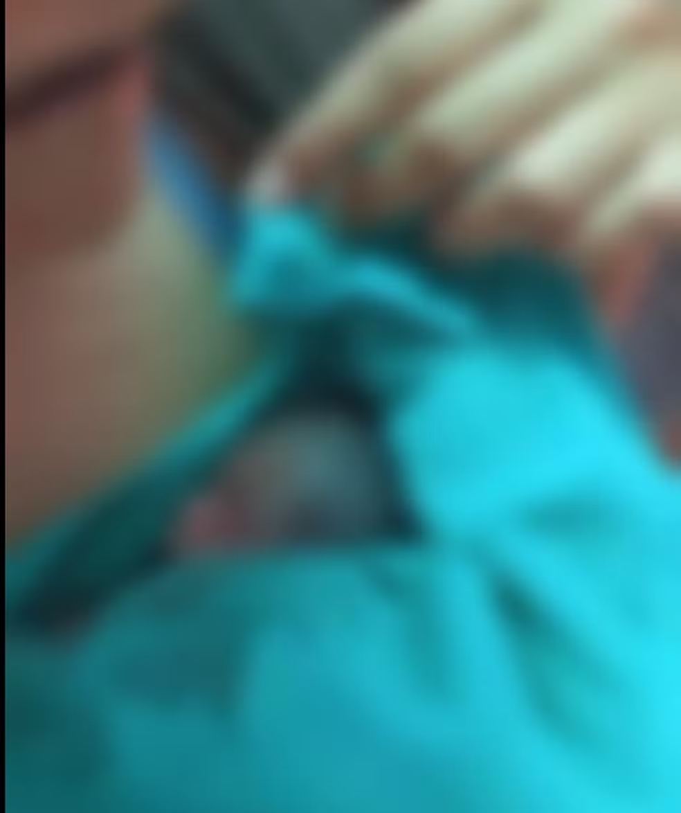 AC – Bebê dado como morto retirado do próprio velório respira com ajuda de aparelhos