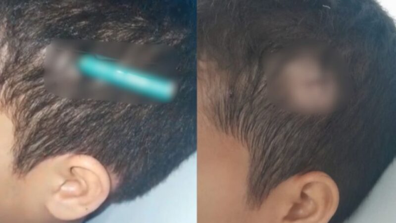 SP – Aluno crava lápis na cabeça de colega em escola