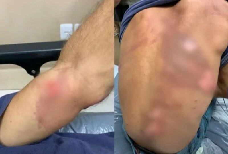 RS – Patrão perfura funcionário com furadeira e o obriga a decepar dedo