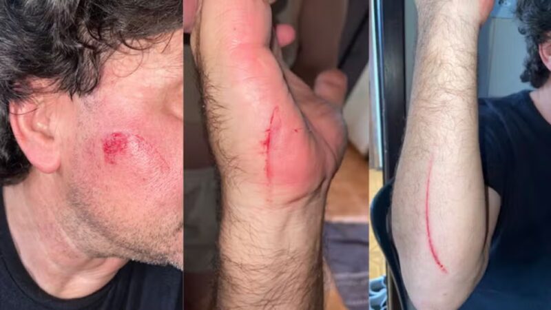Toledo – Motorista de aplicativo é atacado com facão por passageiro durante corrida